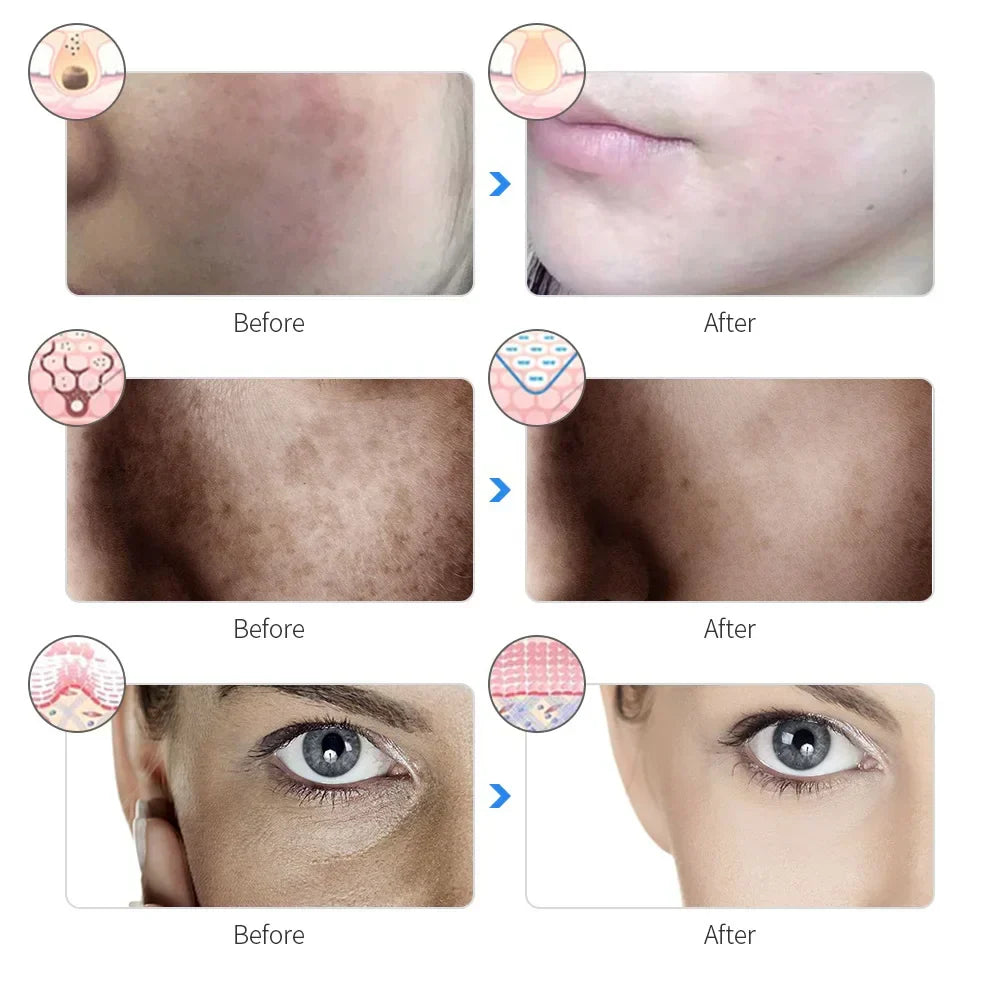 7-Color LED Photon Therapy Rechargeable Facial Mask - Skin Rejuvenation & Beauty Device-4